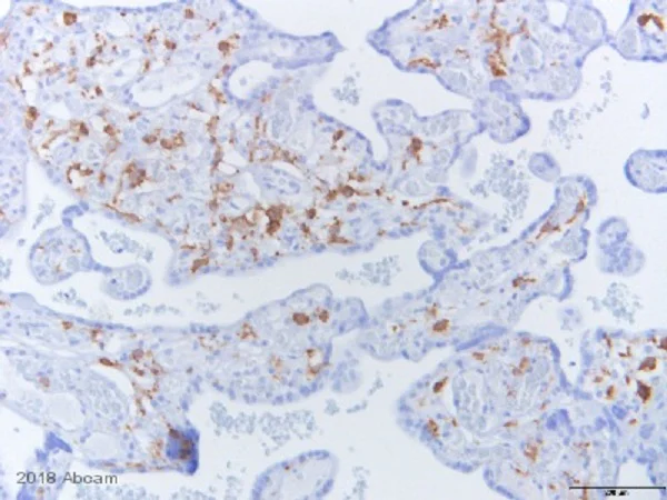 Immunohistochemistry (Formalin/PFA-fixed paraffin-embedded sections) - Anti-CD163 antibody [EPR19518] (AB182422)
