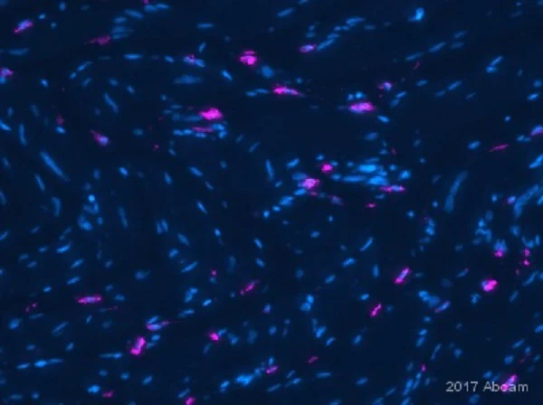 Immunohistochemistry (Formalin/PFA-fixed paraffin-embedded sections) - Anti-CD163 antibody [EPR19518] (AB182422)