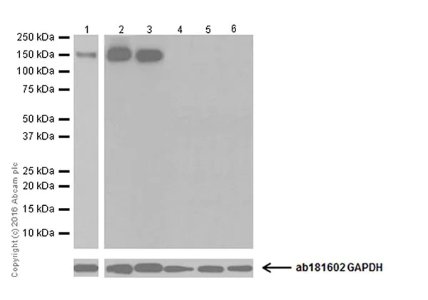 Western blot - Anti-CD163 antibody [EPR19518] (AB182422)
