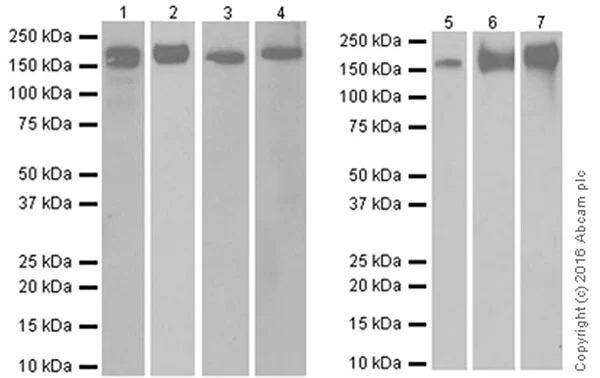 Western blot - Anti-CD163 antibody [EPR19518] (AB182422)