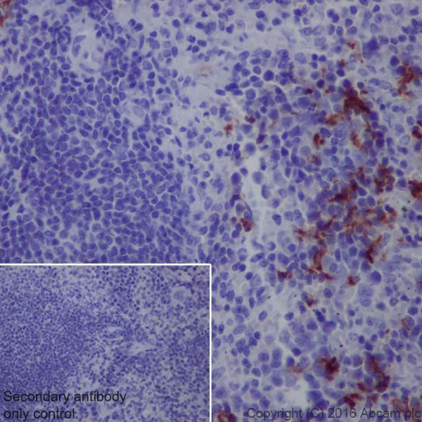 Immunohistochemistry (Formalin/PFA-fixed paraffin-embedded sections) - Anti-CD163 antibody [EPR19518] - BSA and Azide free (AB213612)