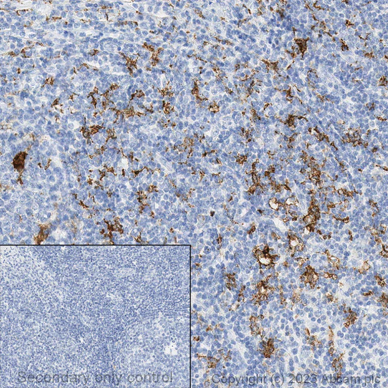 Immunohistochemistry (Formalin/PFA-fixed paraffin-embedded sections) - Anti-CD163 antibody [EPR19518] - BSA and Azide free (AB213612)