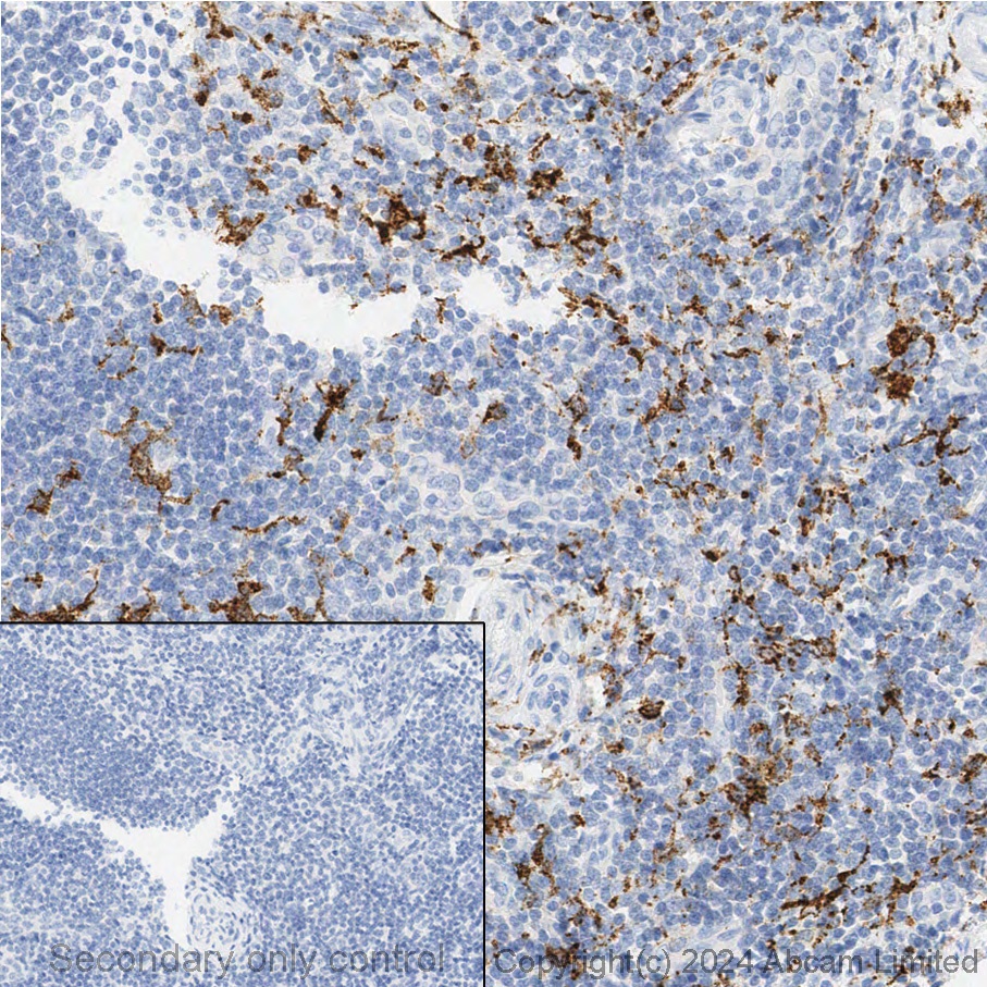 Immunohistochemistry (Formalin/PFA-fixed paraffin-embedded sections) - Anti-CD163 antibody [EPR19518] - BSA and Azide free (ab213612), expandable thumbnail