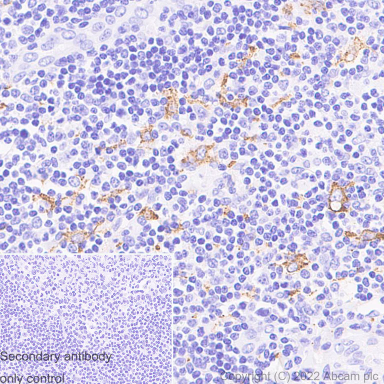 Immunohistochemistry (Formalin/PFA-fixed paraffin-embedded sections) - Anti-CD163 antibody [EPR19518] - Rat IgG2a (Chimeric) (AB289979)