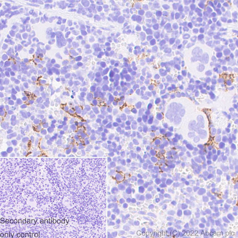 Immunohistochemistry (Formalin/PFA-fixed paraffin-embedded sections) - Anti-CD163 antibody [EPR19518] - Rat IgG2a (Chimeric) (AB289979)