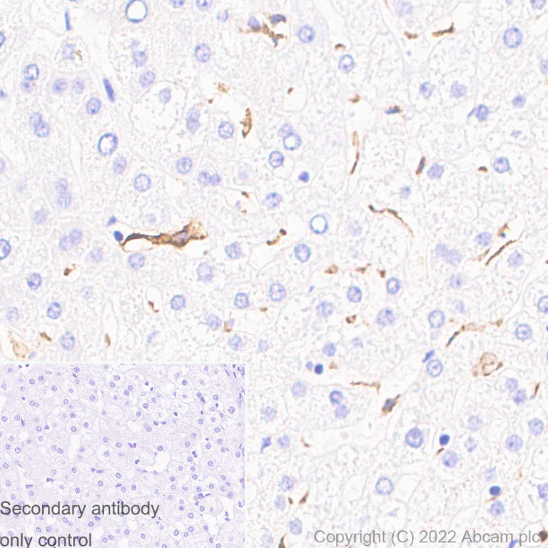 Immunohistochemistry (Formalin/PFA-fixed paraffin-embedded sections) - Anti-CD163 antibody [EPR19518] - Rat IgG2a (Chimeric) - BSA and Azide free (AB290004)