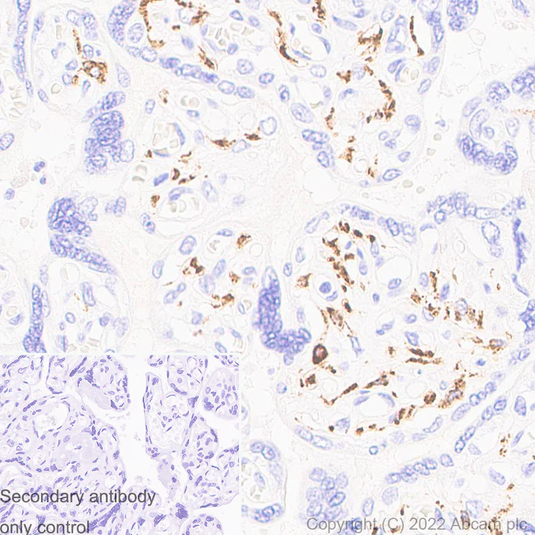 Immunohistochemistry (Formalin/PFA-fixed paraffin-embedded sections) - Anti-CD163 antibody [EPR19518] - Rat IgG2a (Chimeric) - BSA and Azide free (AB290004)