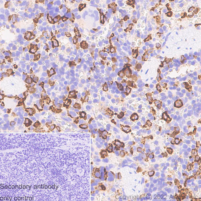Immunohistochemistry (Formalin/PFA-fixed paraffin-embedded sections) - Anti-CD163 antibody [EPR19518] - Rat IgG2a (Chimeric) - BSA and Azide free (AB290004)