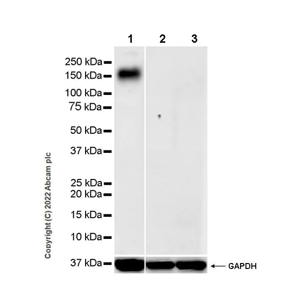 Western blot - Anti-CD163 antibody [EPR19518] - Rat IgG2a (Chimeric) - BSA and Azide free (AB290004)