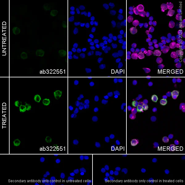 Immunocytochemistry/ Immunofluorescence - Anti-CD163 antibody [EPR29058-507] (AB322551)