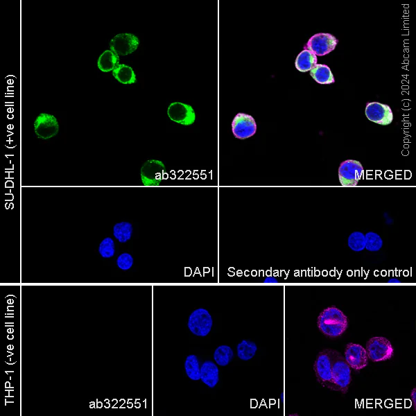 Immunocytochemistry/ Immunofluorescence - Anti-CD163 antibody [EPR29058-507] (AB322551)