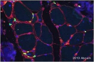 Immunocytochemistry/ Immunofluorescence - Anti-CD163 antibody [OTI2G12] (AB156769)