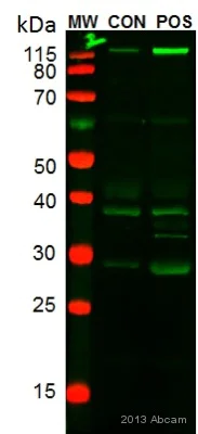 Western blot - Anti-CD163 antibody [OTI2G12] (AB156769)