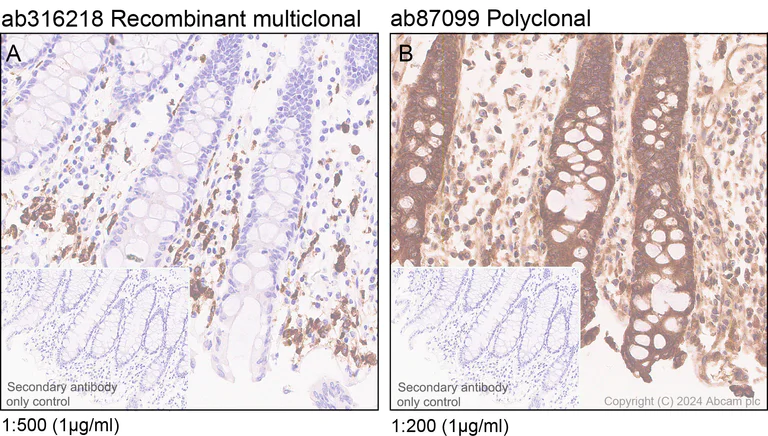 Immunohistochemistry (Formalin/PFA-fixed paraffin-embedded sections) - Anti-CD163 antibody [RM1114] - BSA and Azide free (AB316219)