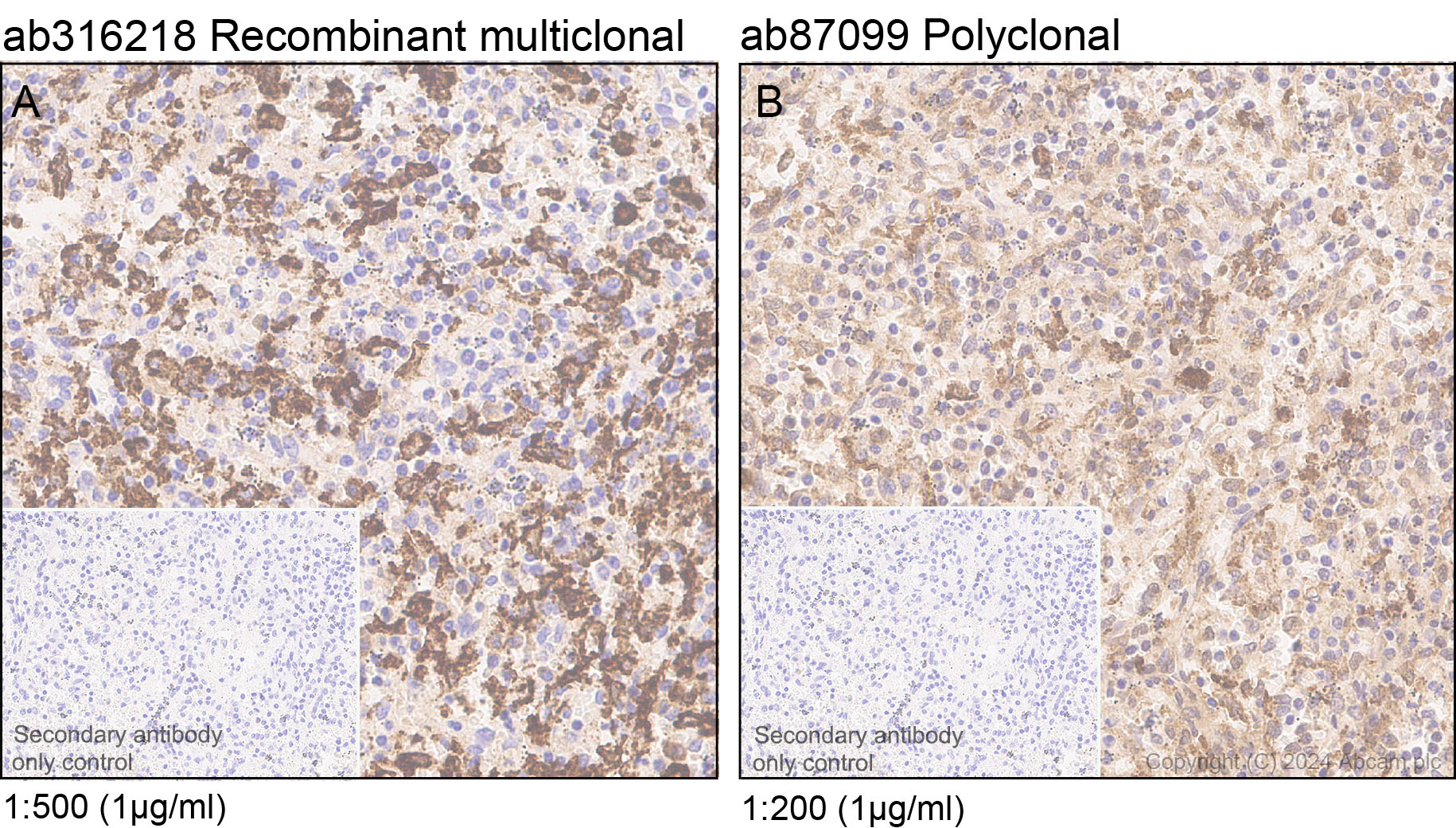 Immunohistochemistry (Formalin/PFA-fixed paraffin-embedded sections) - Anti-CD163 antibody [RM1114] - BSA and Azide free (ab316219), expandable thumbnail
