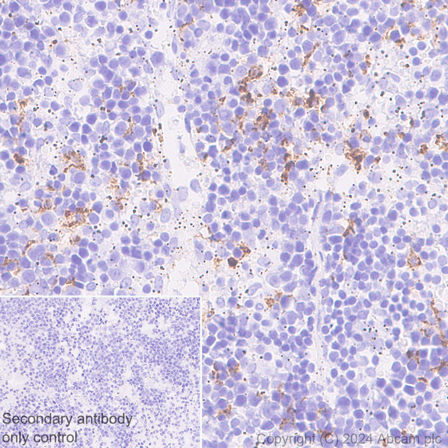 Immunohistochemistry (Formalin/PFA-fixed paraffin-embedded sections) - Anti-CD163 antibody [RM1114] - BSA and Azide free (ab316219), expandable thumbnail