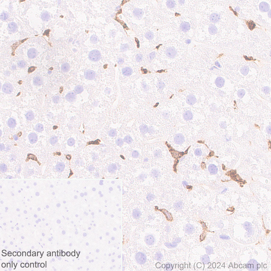 Immunohistochemistry (Formalin/PFA-fixed paraffin-embedded sections) - Anti-CD163 antibody [RM1114] - BSA and Azide free (ab316219), expandable thumbnail
