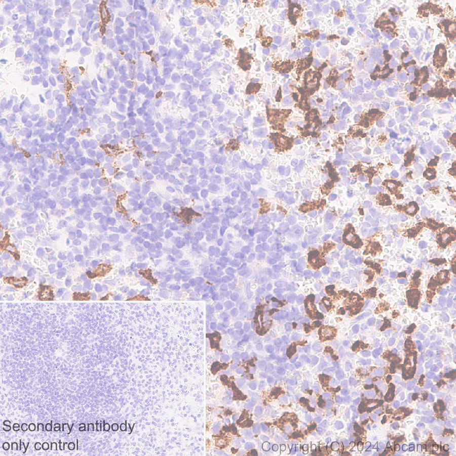 Immunohistochemistry (Formalin/PFA-fixed paraffin-embedded sections) - Anti-CD163 antibody [RM1114] - BSA and Azide free (ab316219), expandable thumbnail