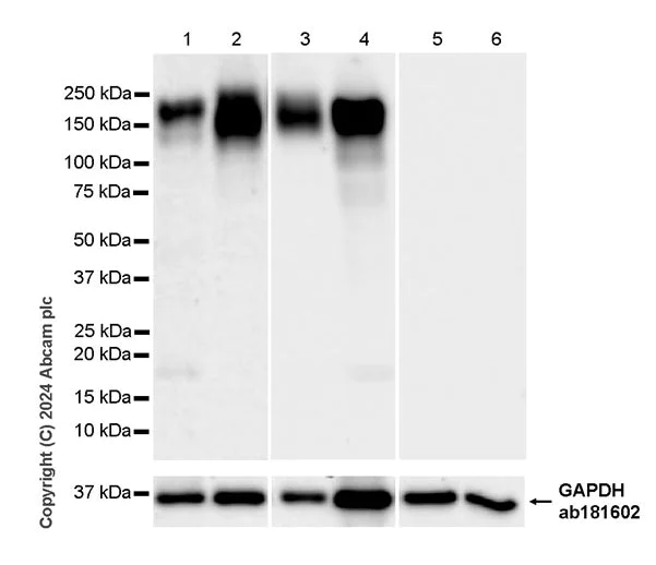 Western blot - Anti-CD163 antibody [RM1114] - BSA and Azide free (AB316219)