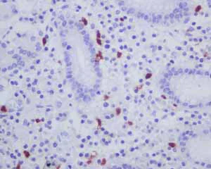 Immunohistochemistry (Formalin/PFA-fixed paraffin-embedded sections) - Anti-CD163L1 antibody [EPR6539] (AB126756)