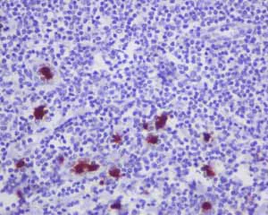 Immunohistochemistry (Formalin/PFA-fixed paraffin-embedded sections) - Anti-CD163L1 antibody [EPR6539] (AB126756)