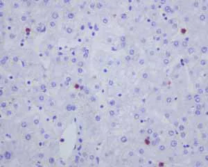 Immunohistochemistry (Formalin/PFA-fixed paraffin-embedded sections) - Anti-CD163L1 antibody [EPR6539] (AB126756)