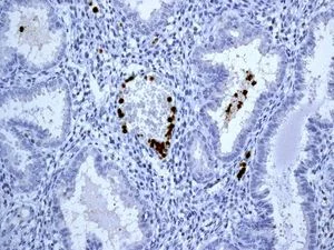Immunohistochemistry (Formalin/PFA-fixed paraffin-embedded sections) - Anti-CD163L1 antibody [EPR6539] (AB126756)
