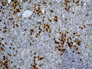 Immunohistochemistry (Formalin/PFA-fixed paraffin-embedded sections) - Anti-CD163L1 antibody [EPR6539] (AB126756)
