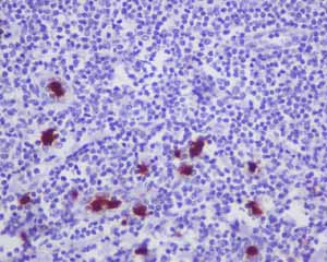 Immunohistochemistry (Formalin/PFA-fixed paraffin-embedded sections) - Anti-CD163L1 antibody [EPR6539] - BSA and Azide free (AB248169), expandable thumbnail