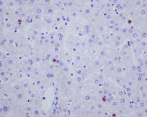 Immunohistochemistry (Formalin/PFA-fixed paraffin-embedded sections) - Anti-CD163L1 antibody [EPR6539] - BSA and Azide free (ab248169), expandable thumbnail