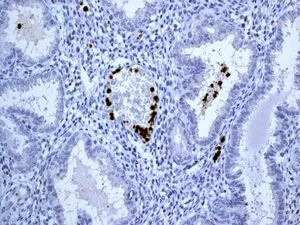 Immunohistochemistry (Formalin/PFA-fixed paraffin-embedded sections) - Anti-CD163L1 antibody [EPR6539] - BSA and Azide free (AB248169), expandable thumbnail