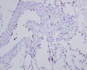 Immunohistochemistry (Formalin/PFA-fixed paraffin-embedded sections) - Anti-CD163L1 antibody [EPR6539] - BSA and Azide free (ab248169), expandable thumbnail