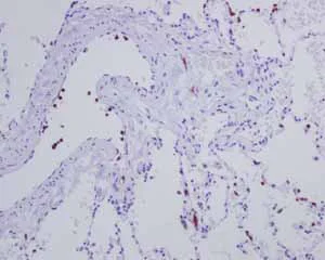 Immunohistochemistry (Formalin/PFA-fixed paraffin-embedded sections) - Anti-CD163L1 antibody [EPR6539] - BSA and Azide free (AB248169)