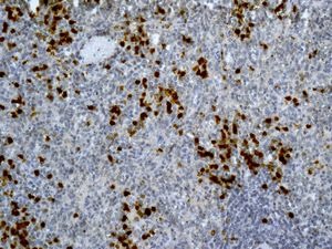 Immunohistochemistry (Formalin/PFA-fixed paraffin-embedded sections) - Anti-CD163L1 antibody [EPR6539] - BSA and Azide free (AB248169), expandable thumbnail