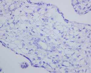 Immunohistochemistry (Formalin/PFA-fixed paraffin-embedded sections) - Anti-CD163L1 antibody [EPR6539] - BSA and Azide free (ab248169), expandable thumbnail