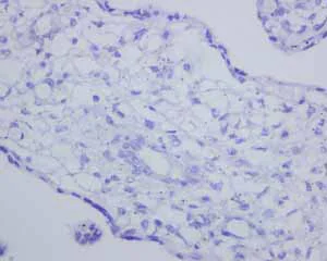 Immunohistochemistry (Formalin/PFA-fixed paraffin-embedded sections) - Anti-CD163L1 antibody [EPR6539] - BSA and Azide free (AB248169)