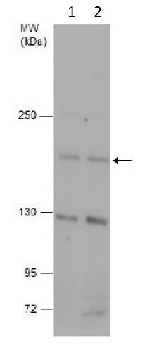 Western blot - Anti-CD163L1 antibody - N-terminal (AB227300)