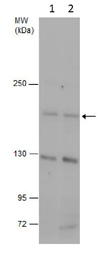 Western blot - Anti-CD163L1 antibody - N-terminal (AB227300)