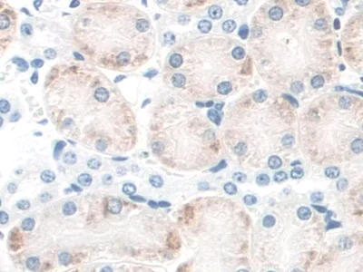 Immunohistochemistry (Formalin/PFA-fixed paraffin-embedded sections) - Anti-CD164 antibody (AB231131)
