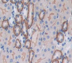 Immunohistochemistry (Formalin/PFA-fixed paraffin-embedded sections) - Anti-CD164 antibody (AB231131)