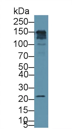 Western blot - Anti-CD164 antibody (AB231131)
