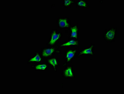 Immunocytochemistry - Anti-CD164 antibody (AB238748)