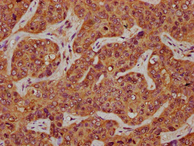 Immunohistochemistry (Formalin/PFA-fixed paraffin-embedded sections) - Anti-CD164 antibody (AB238748)