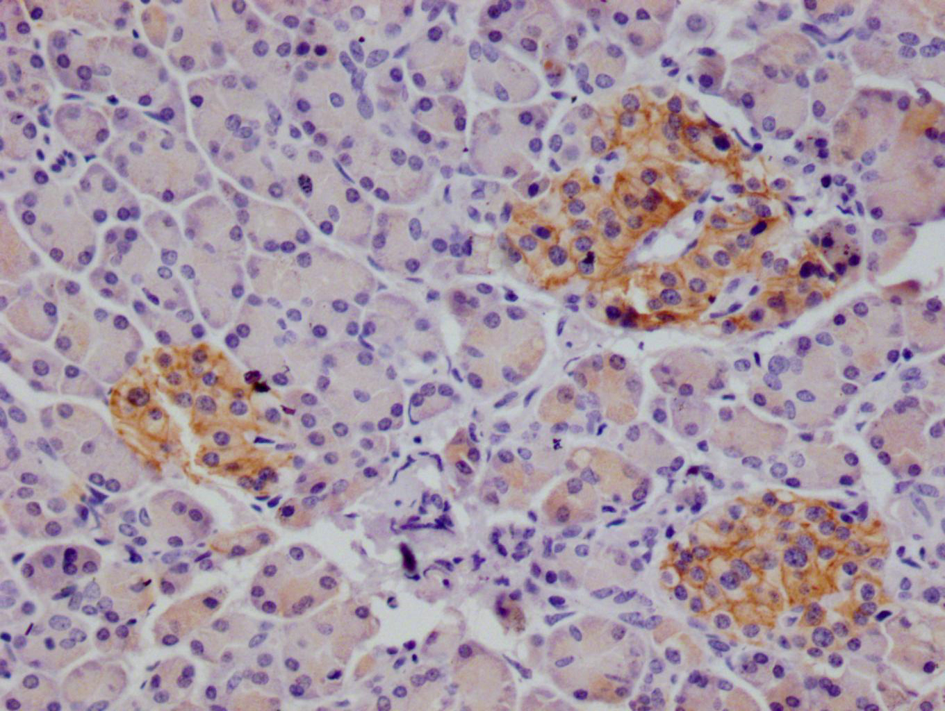 Immunohistochemistry (Formalin/PFA-fixed paraffin-embedded sections) - Anti-CD166 antibody [21B9] (AB314178), expandable thumbnail