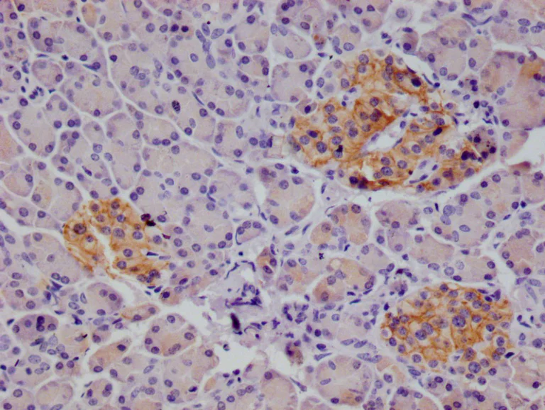 Immunohistochemistry (Formalin/PFA-fixed paraffin-embedded sections) - Anti-CD166 antibody [21B9] (AB314178)