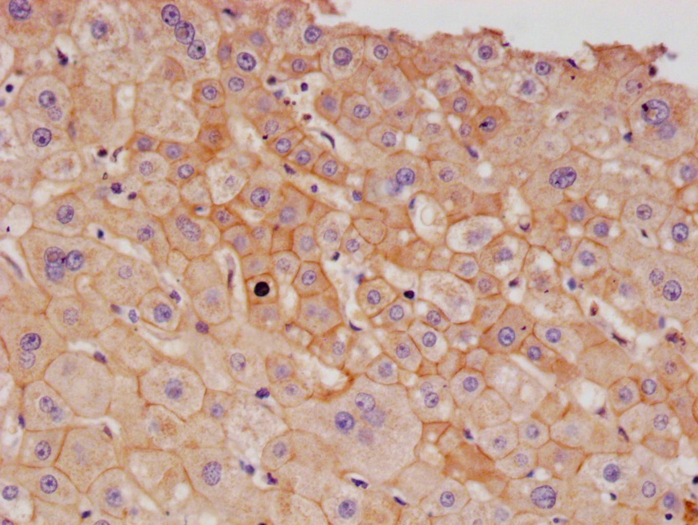 Immunohistochemistry (Formalin/PFA-fixed paraffin-embedded sections) - Anti-CD166 antibody [21B9] (AB314178), expandable thumbnail
