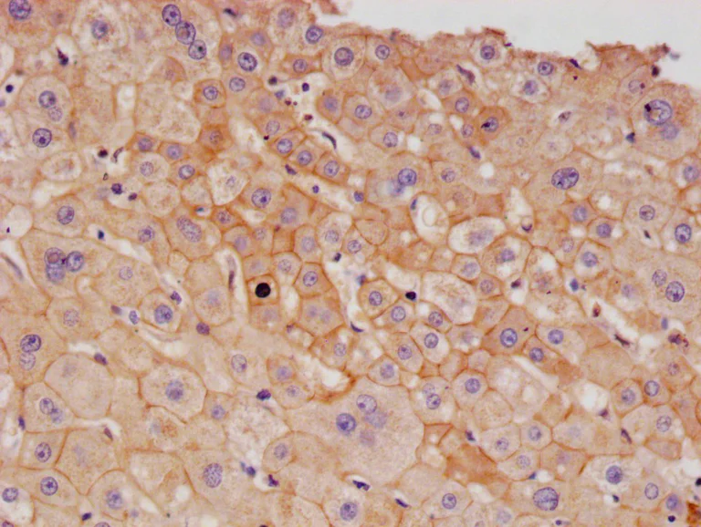 Immunohistochemistry (Formalin/PFA-fixed paraffin-embedded sections) - Anti-CD166 antibody [21B9] (AB314178)