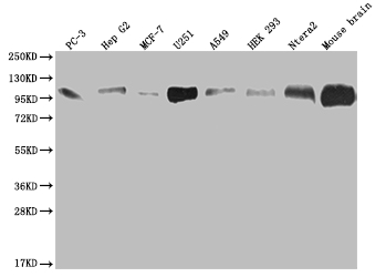 Western blot - Anti-CD166 antibody [21B9] (AB314178), expandable thumbnail