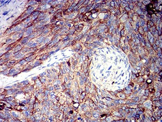 Immunohistochemistry (Formalin/PFA-fixed paraffin-embedded sections) - Anti-CD166 antibody [3D9F1] (AB233750)