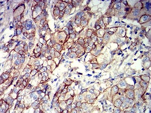 Immunohistochemistry (Formalin/PFA-fixed paraffin-embedded sections) - Anti-CD166 antibody [3D9F1] (AB233750)